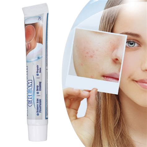 Scar Removal Cream 20g Skin Solution For Scars Scar Cream For Old Scars