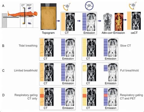 A Standard Whole Body Pet Ct Examination Protocol A Topogram Followed