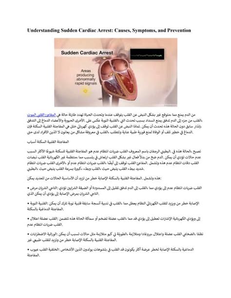 Understanding Sudden Cardiac Arrest Causes Symptoms And Prevention Pdf