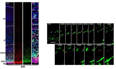 王晓群研究组发表皮层发育研究新结果 脑与认知科学国家重点实验室