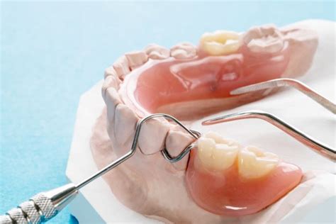 Different types of partial dentures from which to choose