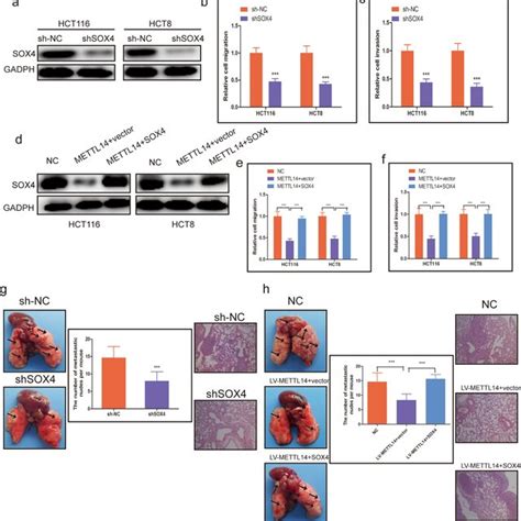 METTL14 Inhibits CRC Cell Migration Invasion And Metastasis A The