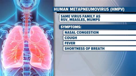 What to know about human metapneumovirus | GMA