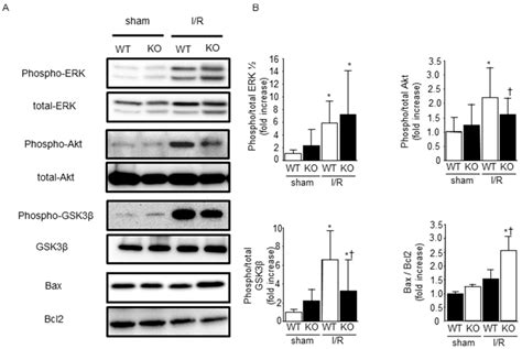 IJMS Free Full Text Deficiency Of Senescence Marker Protein 30