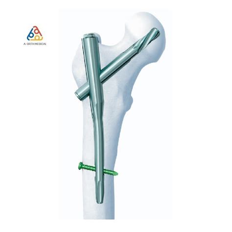 Orthopedic Pfna Proximal Femoral Intramedullary Nail for Titanium ...