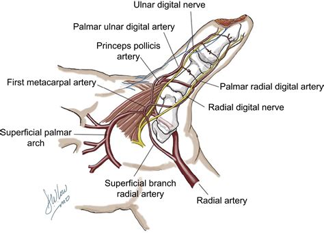 Ulnar Thumb Pulp Reconstruction Using The Anterograde Homodigital Neurovascular Island Flap