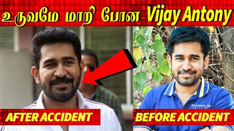 Vijay Antony S Video After His Accident Pichaikkaran Audio Launch