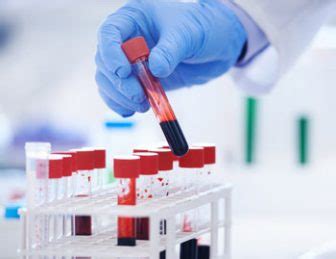 UPenn Research With Mesothelioma Blood Test Shows Promise