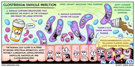 Clostridium difficile Infection | Medcomic