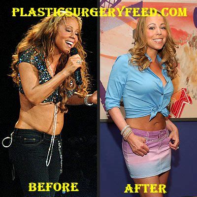 Mariah Carey Plastic Surgery - Plastic Surgery Feed