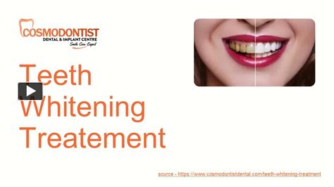 Ppt Teeth Whitening Treatment Powerpoint Presentation Free To