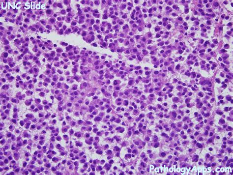 Plasma Cells Histology