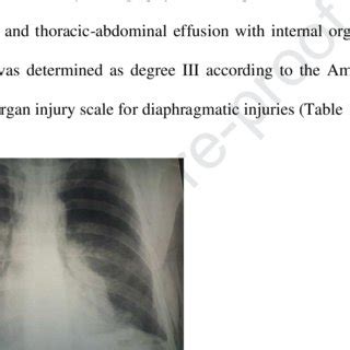 Chest X-ray tomography detection of hemopneumothorax on the right side. 36 | Download Scientific ...