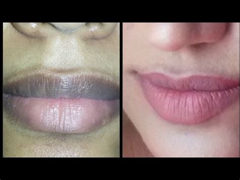 How To Apply Nude Lipstick On Pigmented Dark Lips