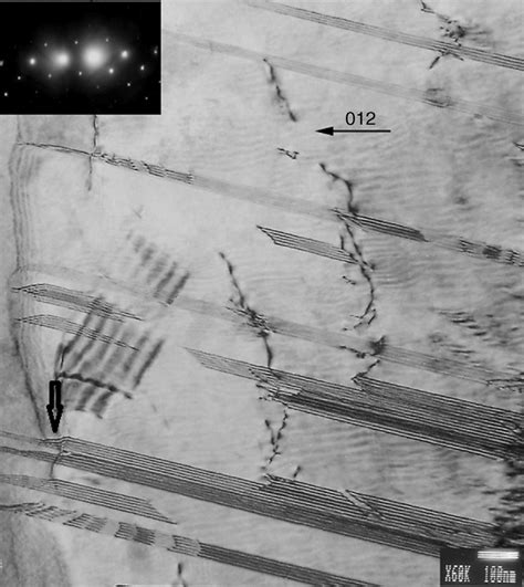 Tem Image Bright Field Of Dislocations Surface Zone On Sample With