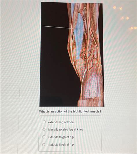 Solved What Is An Action Of The Highlighted Muscleextends
