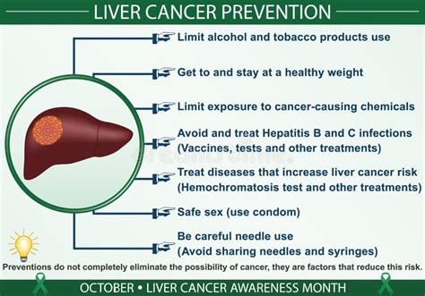 Liver Cancer Prevention Infographic Vector Illustration Stock Vector Illustration Of Liver