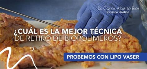 Cuál es la mejor técnica para retiro de biopolímeros