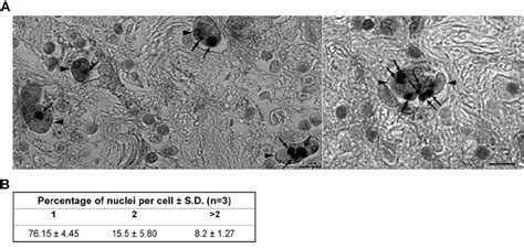 E Histolytica Trophozoites Show Heterogeneity In Nuclear Number During Download Scientific