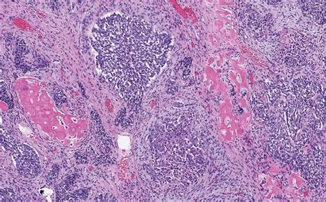 pathoma book  pathology