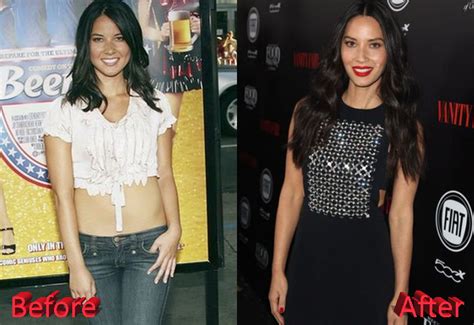 Olivia Munn Plastic Surgery: Just Gossips?