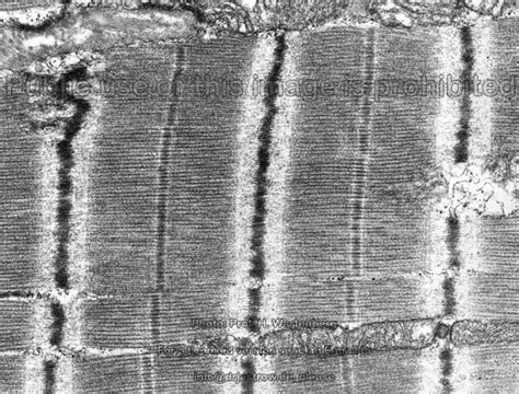 Heart Muscle Dr Jastrows Electron Microscopic Atlas