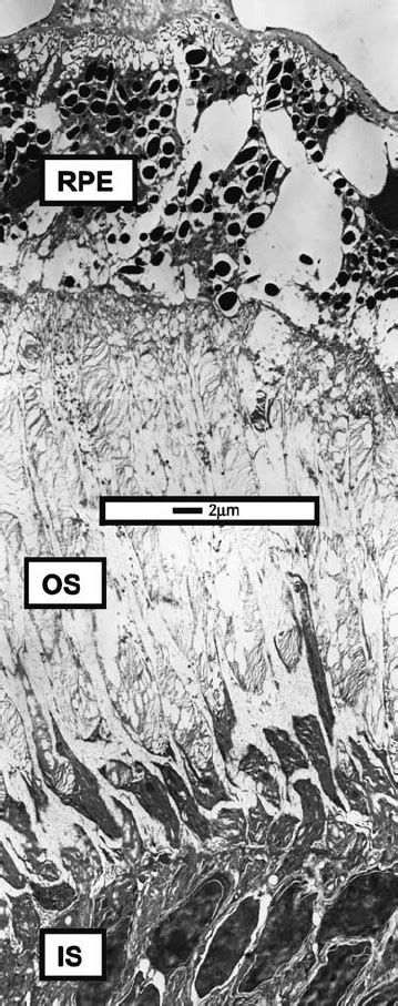 Tem Image Of The Naked Mole Rat Distal Retina Visible Are The Retinal