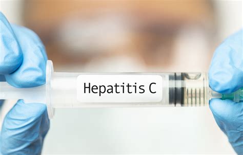 The Hepatitis C Story From The Beginning To Today Offline Post