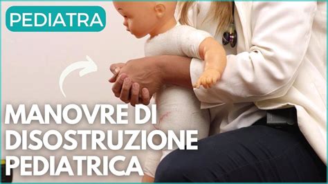 MANOVRE DI DISOSTRUZIONE PEDIATRICA NEL BAMBINO SOPRA I 12 MESI DI ETÀ