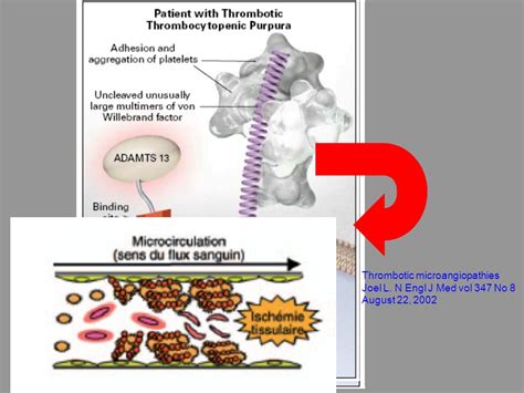 Prise En Charge Diagnostique Des Microangiopathies Thrombotiques Ppt