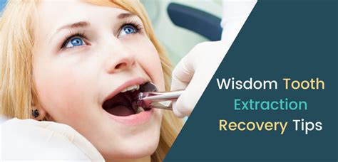 6 Tips For Quick Recovery Post Wisdom Tooth Extraction Kalyani Dental Clinic