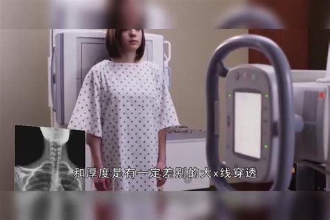 为什么很多女生都害怕做“胸透”，医生到底能从屏幕上看到什么医生屏幕女生