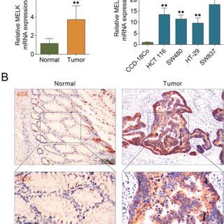 The Expression Of Melk Is Upregulated In Crc Tissues And Cells A The