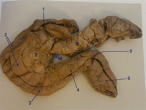 Duodenum Pancreas Diagram Quizlet