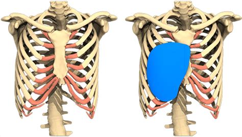 Clinical Case Deep Lateral Pectus By Dr Debrosse Anatomikmodeling