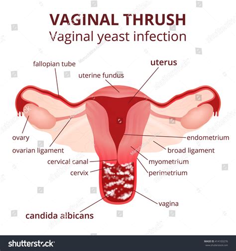 Female Reproductive System Uterus Ovaries Scheme 库存矢量图（免版税）414103276 Shutterstock