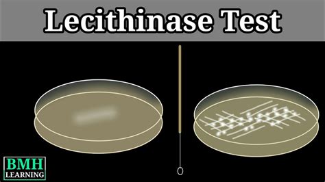 Lecithinase Test Nagler S Reaction Clostridium Testing Method