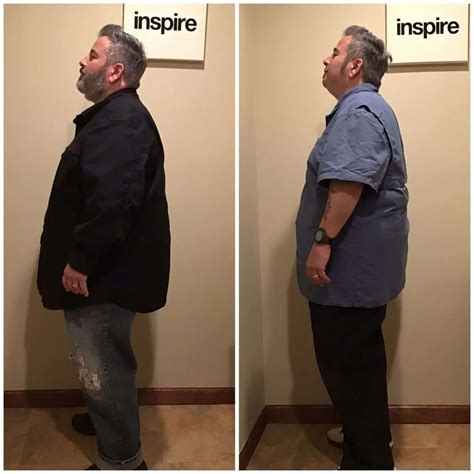 Gallery Inspire Weight Loss Nutley