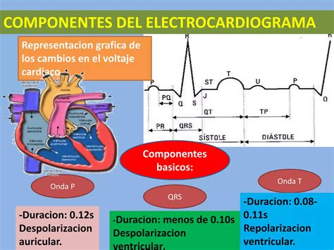 Componentes Del Electrocardiograma Ppt