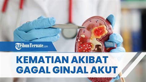 Sebanyak Persen Kematian Akibat Gangguan Ginjal Akut Terjadi Usia