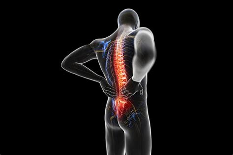 Why Structural Correction Chiropractic Care For Low Back Pain In Miami