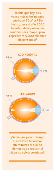 Lentes De Contacto Para El Control De La Miopía Confort Visión