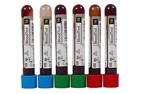 Sfri Hematology Reagents