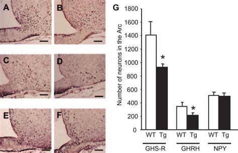 Localization Ghs R Positive Neurons Ghrh Neurons And Npy Neurons In