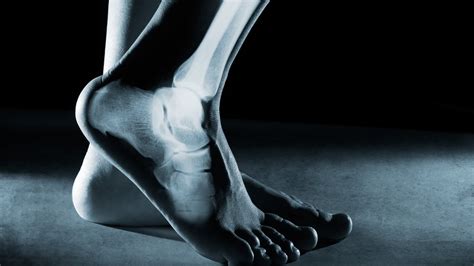 Why Do Your Feet Hurt? — Coast Performance Rehab