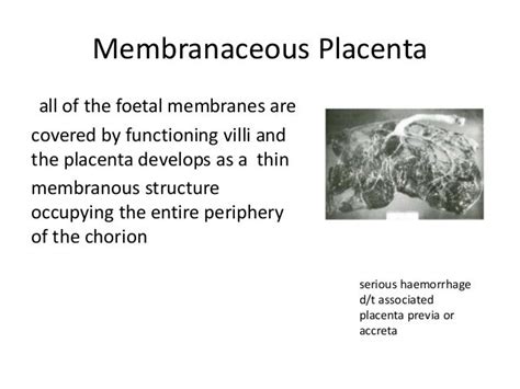 Sites Of Implantation Of Embryo