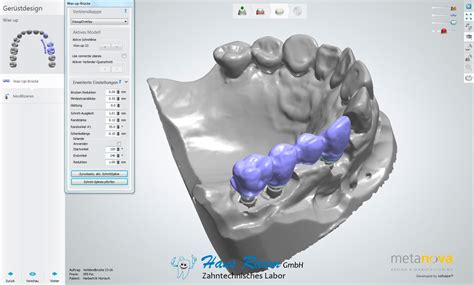 Cad Cam Zahntechnik Raum