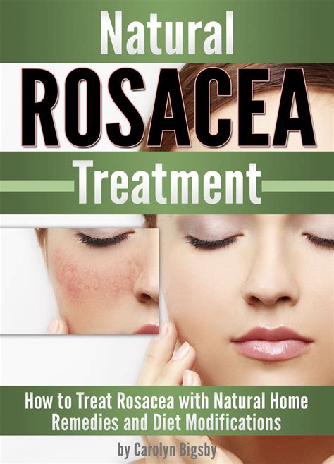 Natural Rosacea Treatment: How to Treat Rosacea with Natural Home ...