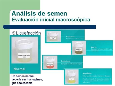 Curso Anlisis De Semen Segn Los Criterios De