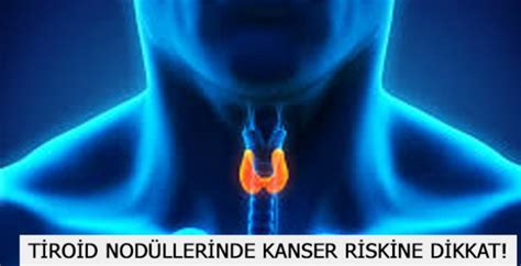 TİROİD NODÜLLERİNDE KANSER RİSKİNE DİKKAT Sağlık Kapsam Haber